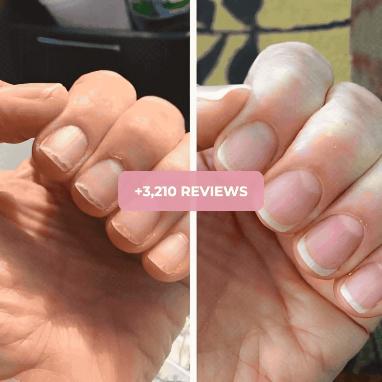 RevitaGlow™ Nail Growth Oil