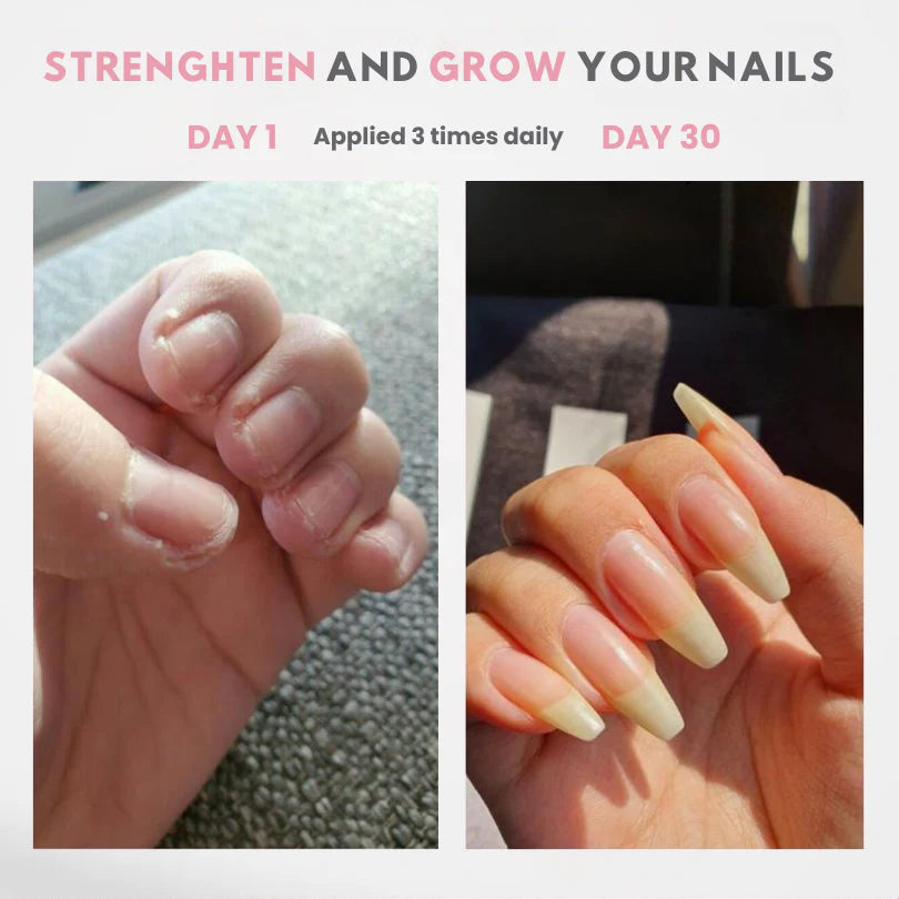 RevitaGlow™ Nail Growth Oil