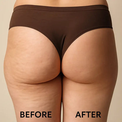 Anti-Cellulite Massage Oil