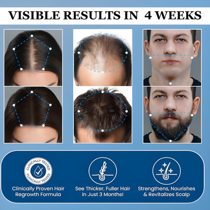 Vantique | Hair Growth Serum