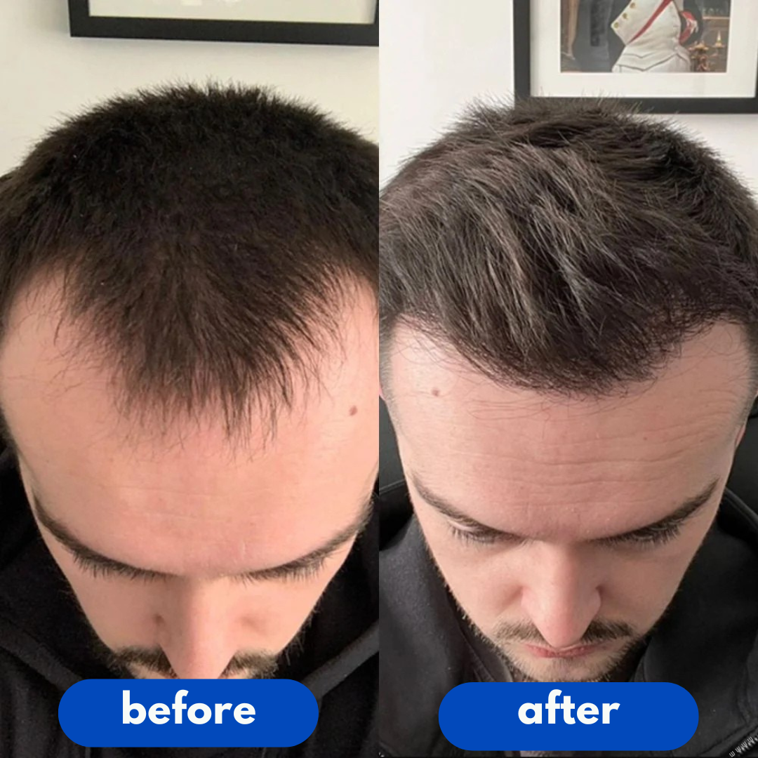 Vantique | Hair Growth Serum